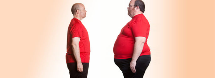 gastric-bypass-revision