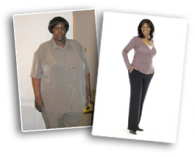 weight-loss-surgery.jpg weight-loss-surgery.jpg