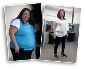 bariatric-weight-loss