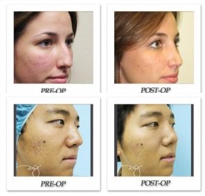 Differences (and Similarities) Between Male and Female Plastic Surgery Patients