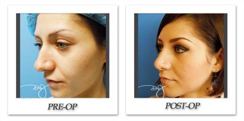 Procedures for Younger Patients