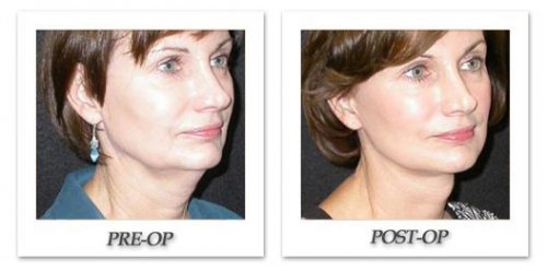 Plastic Surgery is Just Another Aspect of Contemporary Life