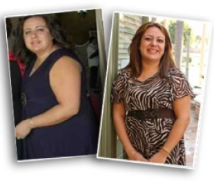 weight loss surgery success story