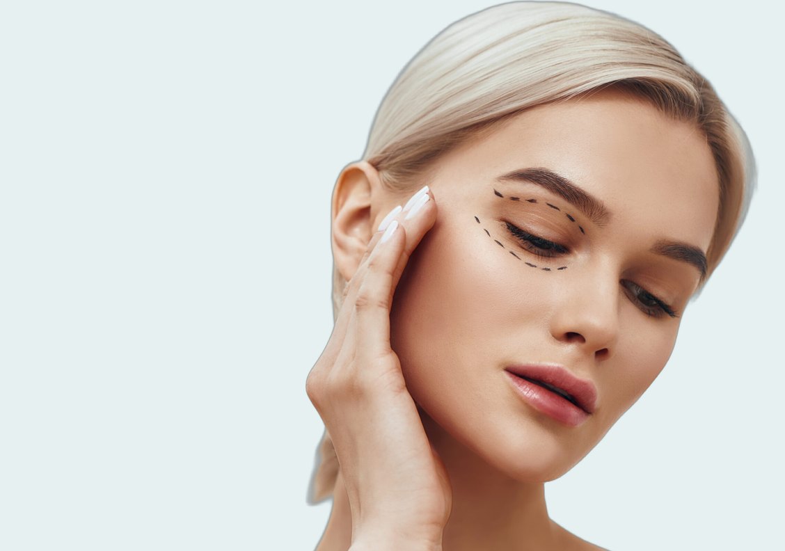 Blepharoplasty