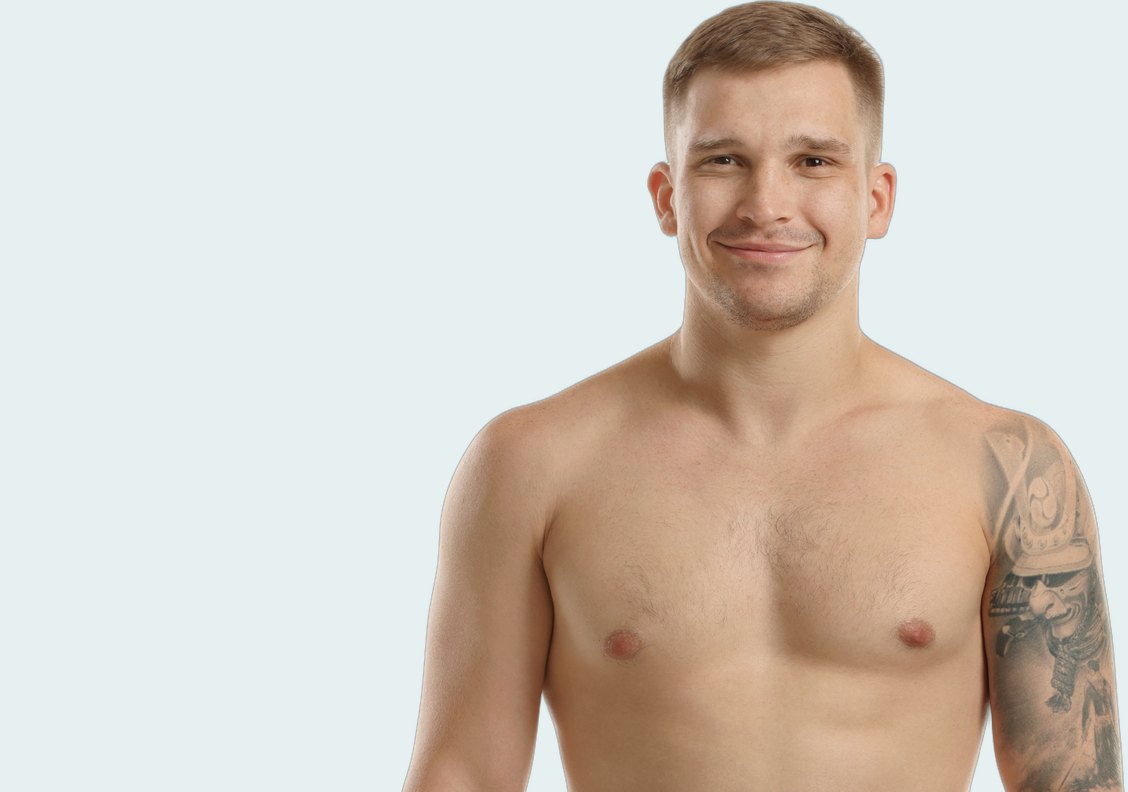 Gynecomastia