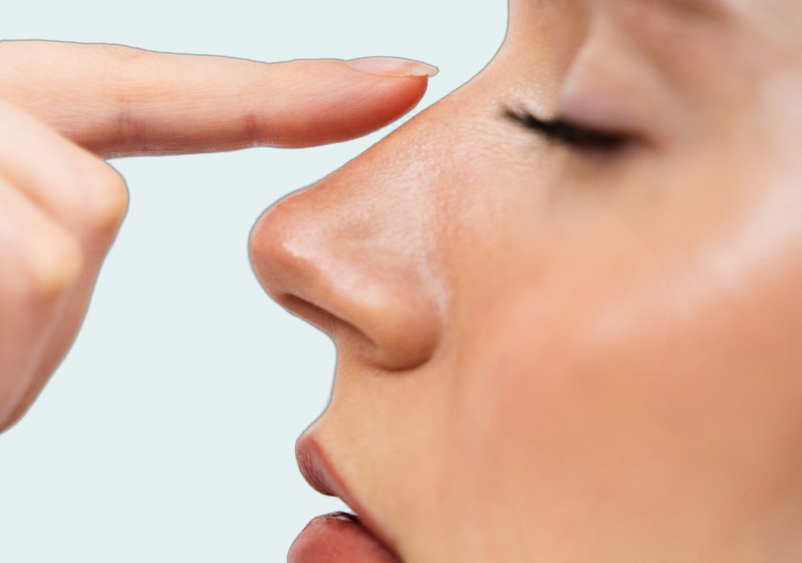 Rhinoplasty