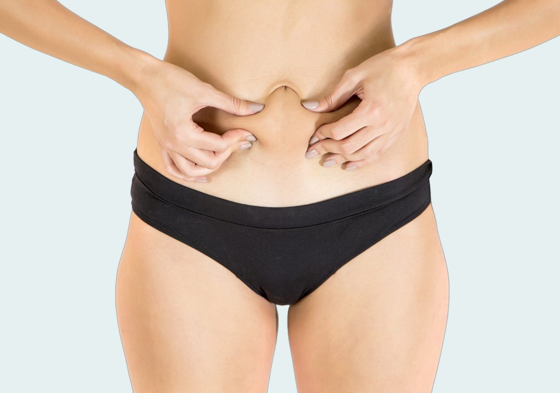 Tummy Tuck
